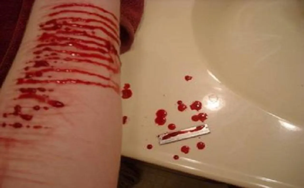 Self-Injury Awareness Day: Here's what you should do to save a loved one from mental health condition