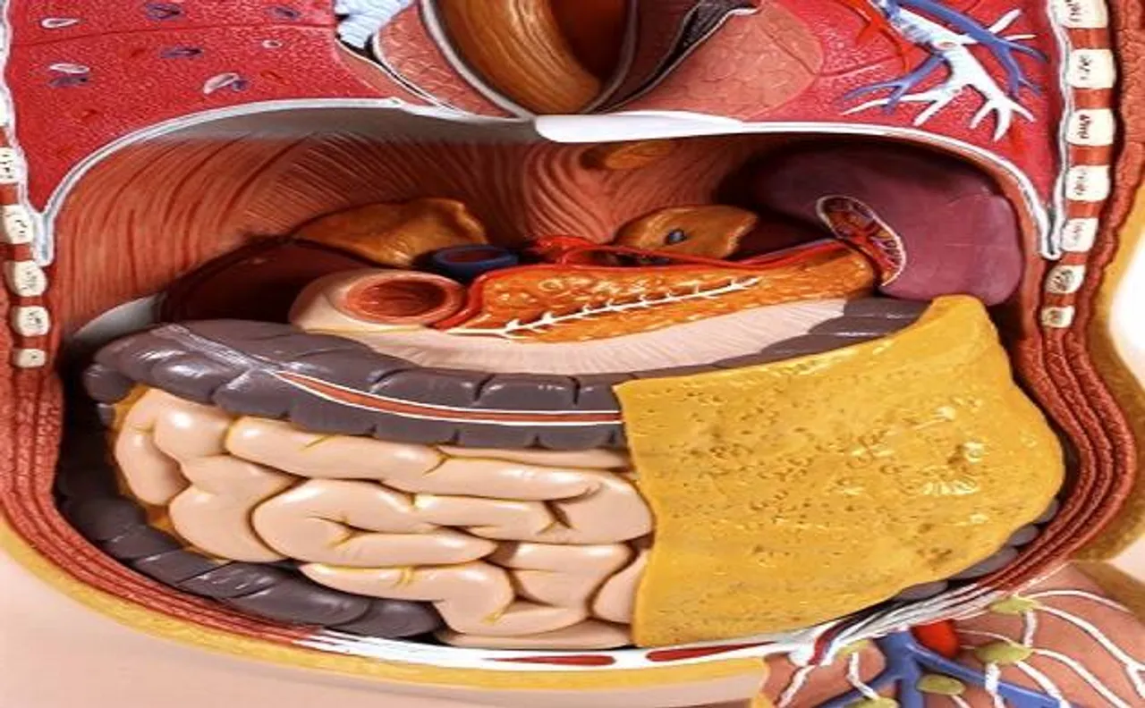 Doctors at New Delhi hospital removes 838 stones from woman's gallbladder
