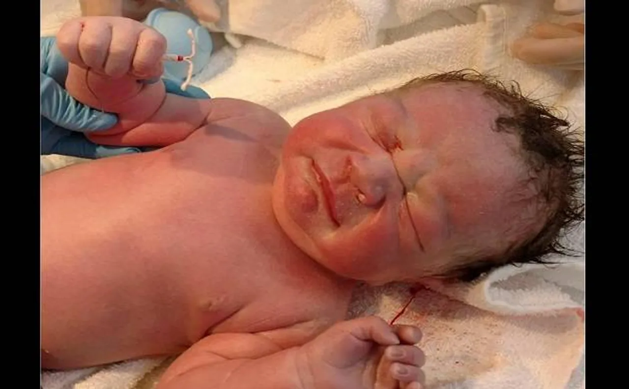 Picture of baby holding birth control device goes viral on social media
