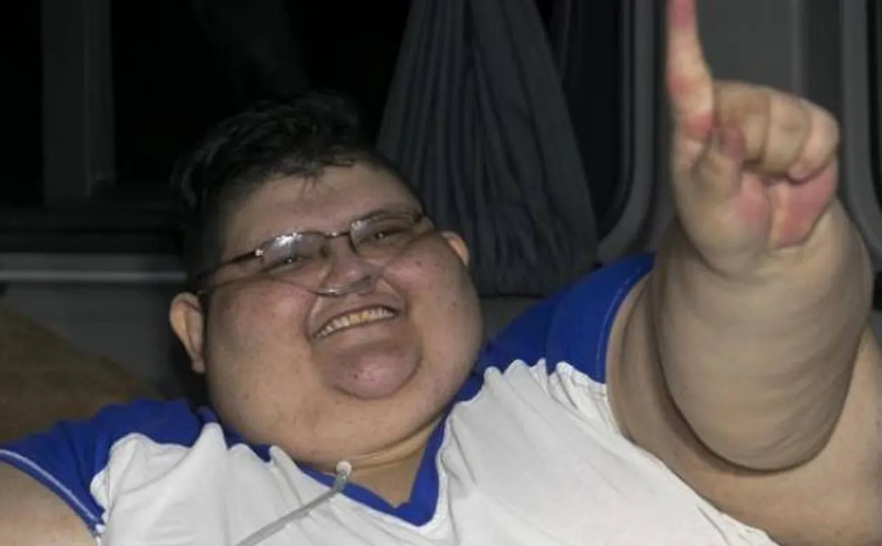 Heaviest man in the world undergoes successful gastric bypass surgery in Mexico