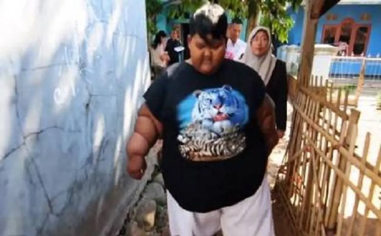 Ten-year-old boy suffering from abnormal weight, addicted to cola and noodles