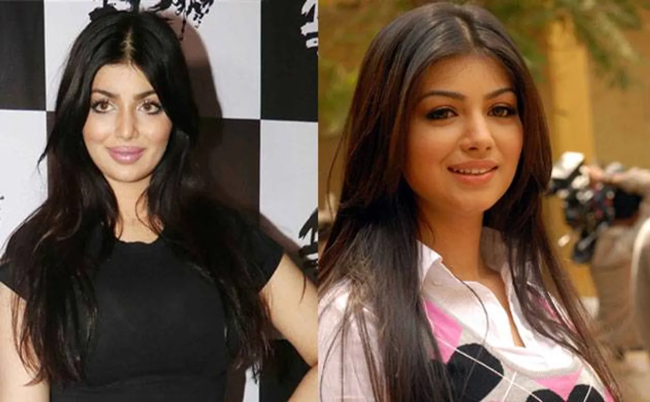 Ayesha Takia BREAKS silence on her lip job, says 'didn't go under the knife'