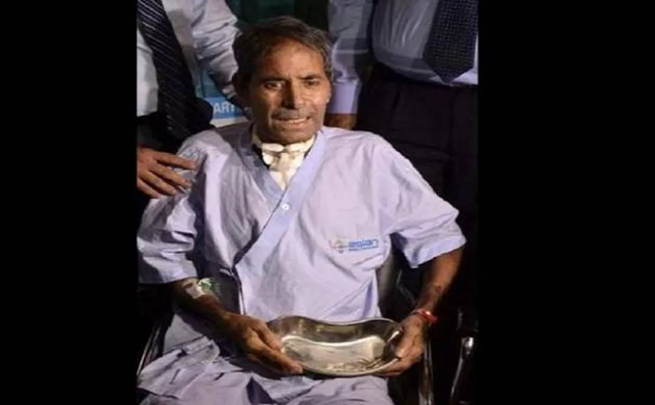 Rajasthan man survives despite eating 150 needles and pins