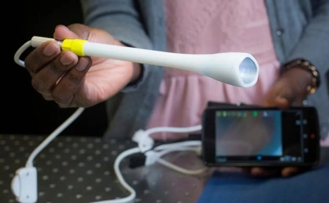 Handheld device for cervical cancer screening developed by an Indian-American