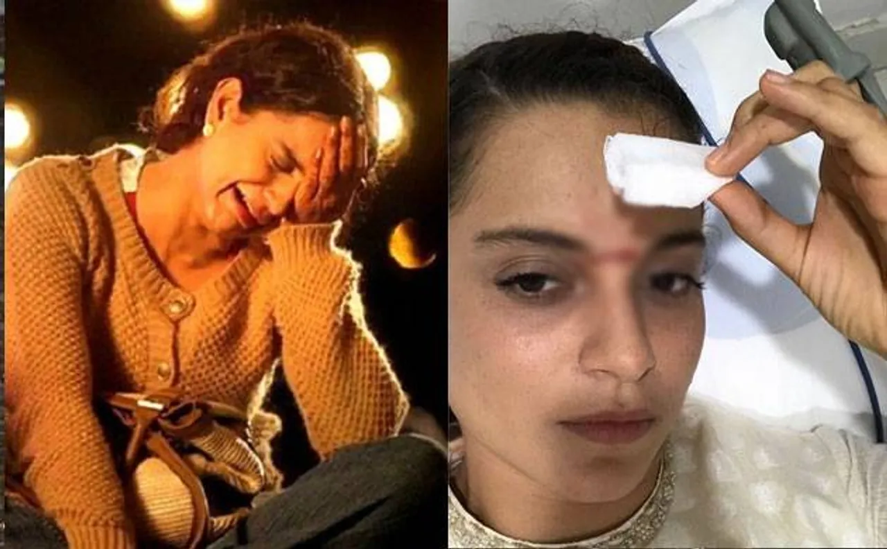 Kangana Ranaut injured on 'Manikarnika' sets; gets 15 stitches on face (see pic)