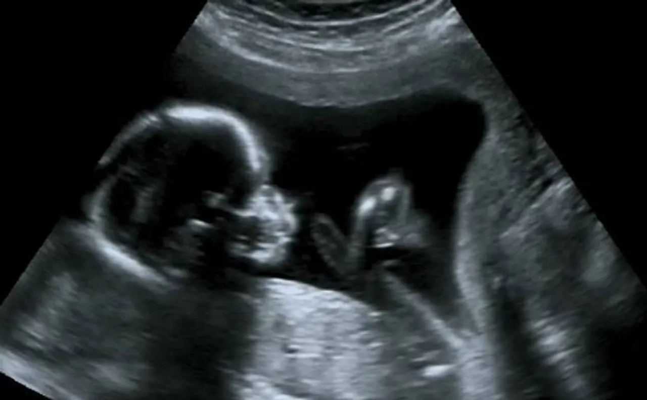 'Fetus-in-Fetu' case: Baby boy carrying twin in stomach, born in Mumbra