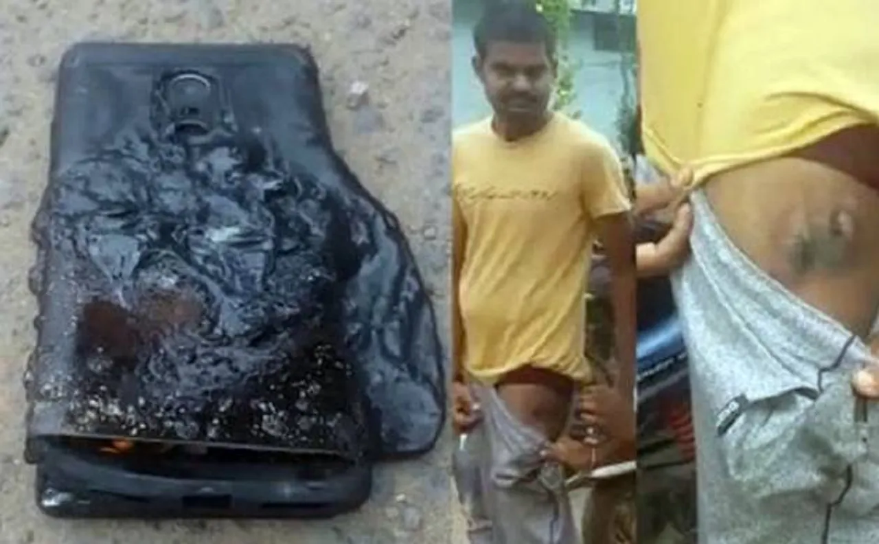 Xiaomi Redmi Note 4 explodes in pocket of owner, suffers injury