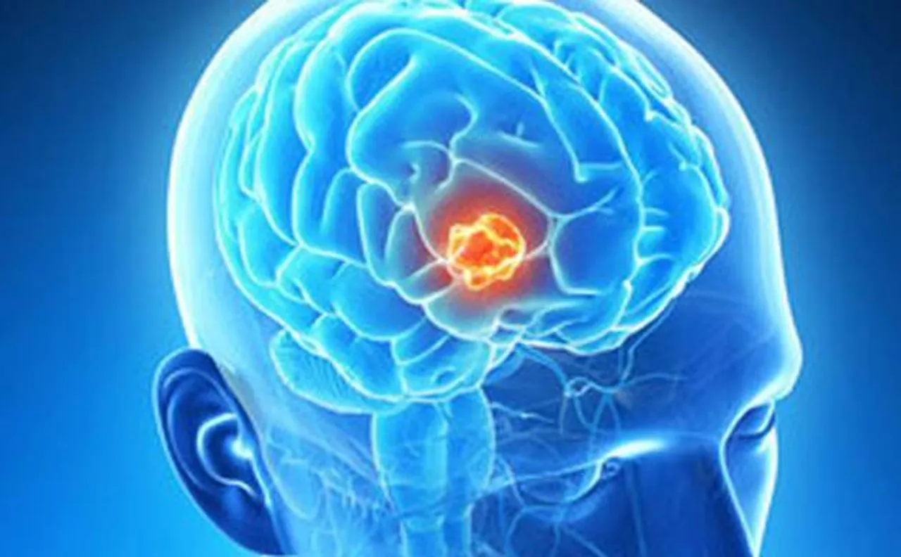 Mangalore: Scientists develop drug delivery method to target brain tumour