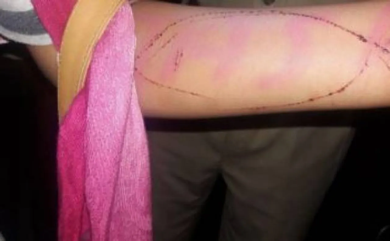 Blue Whale Challenge: Jodhpur police rescues girl trying to commit suicide 