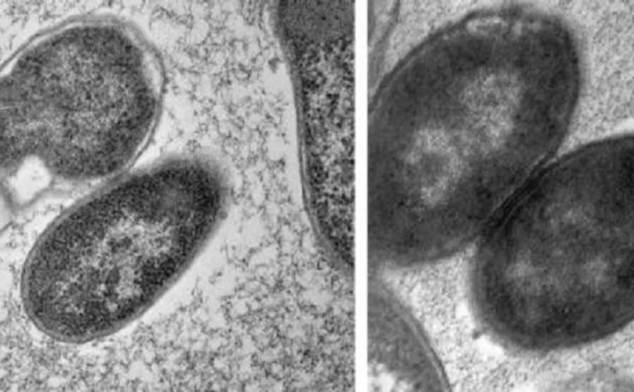 Bacteria shape-shift on exposure to antibiotics in space, reveals study
