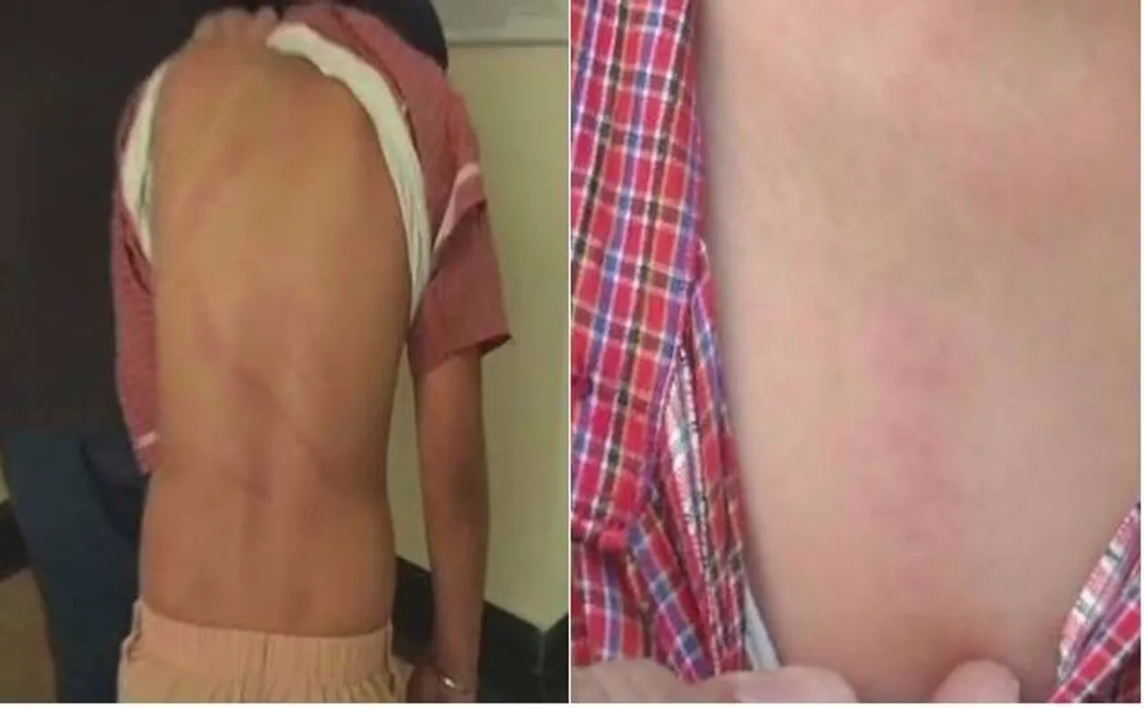 Punjab: Ryan International School student allegedly beaten up by 2 teachers