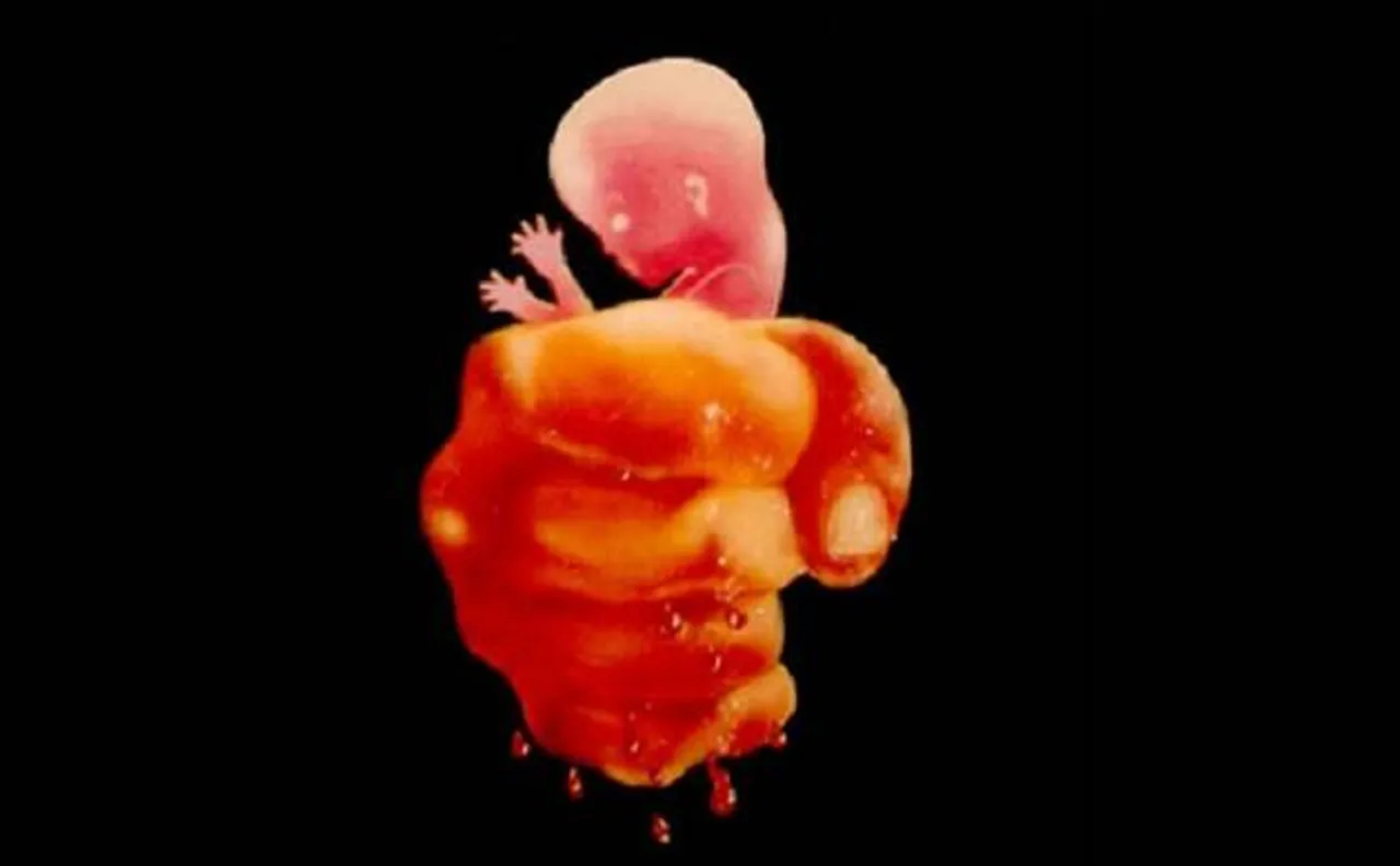 Beti Bachao: With female foeticide on the rise, laws to prevent this brutal form of killing