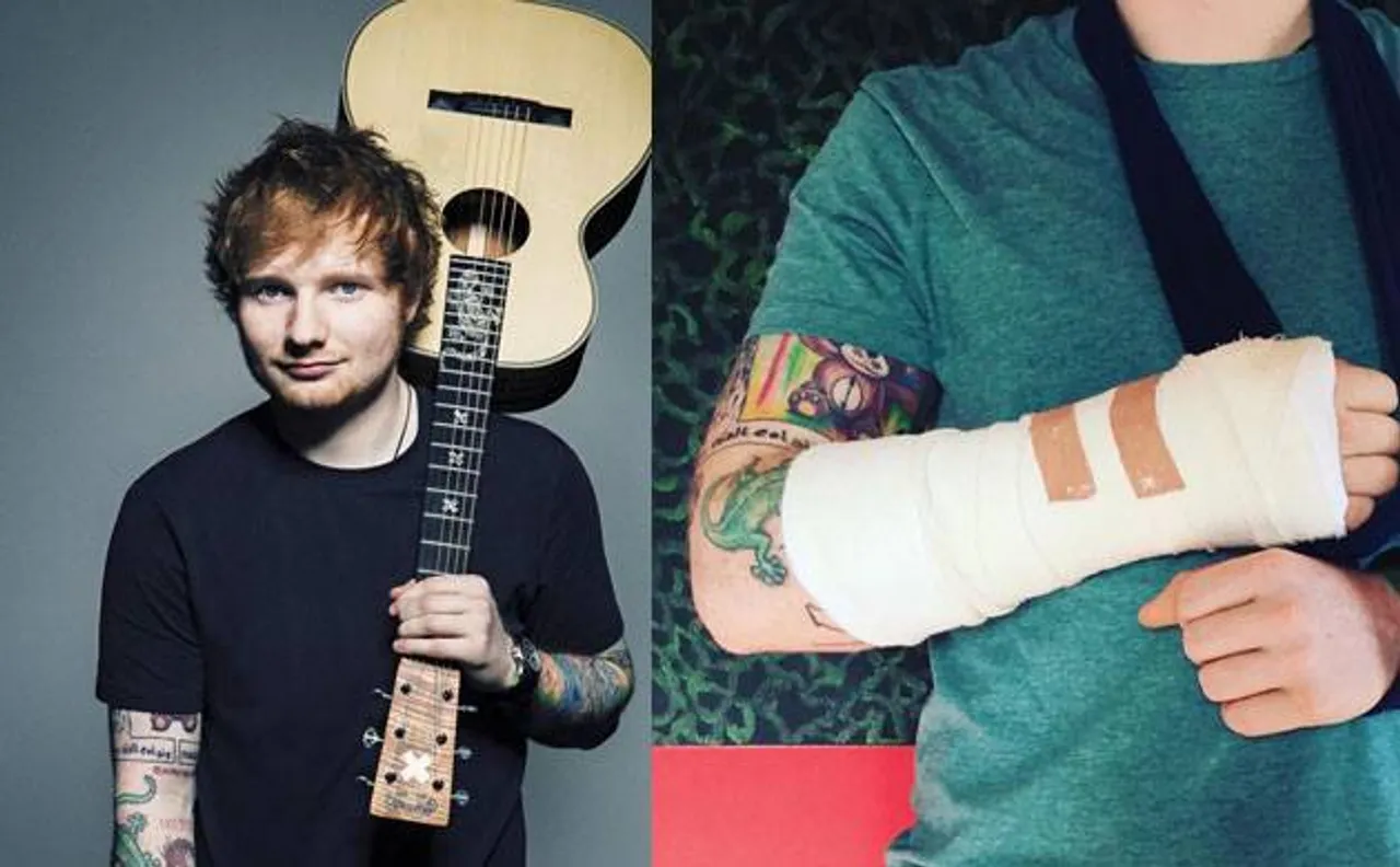 Ed Sheeran gets injured in bike accident