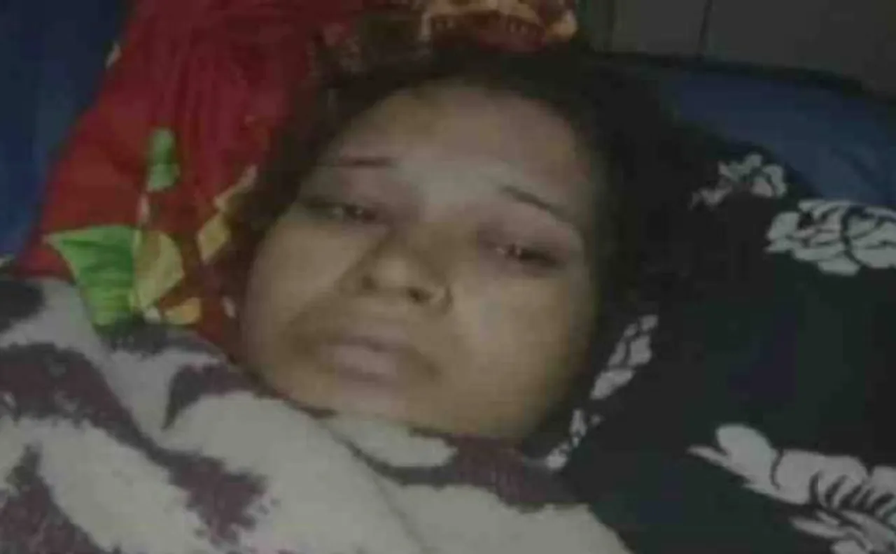 Madhya Pradesh: 50 women fall ill in Gwalior govt hospital after antibiotic injection 