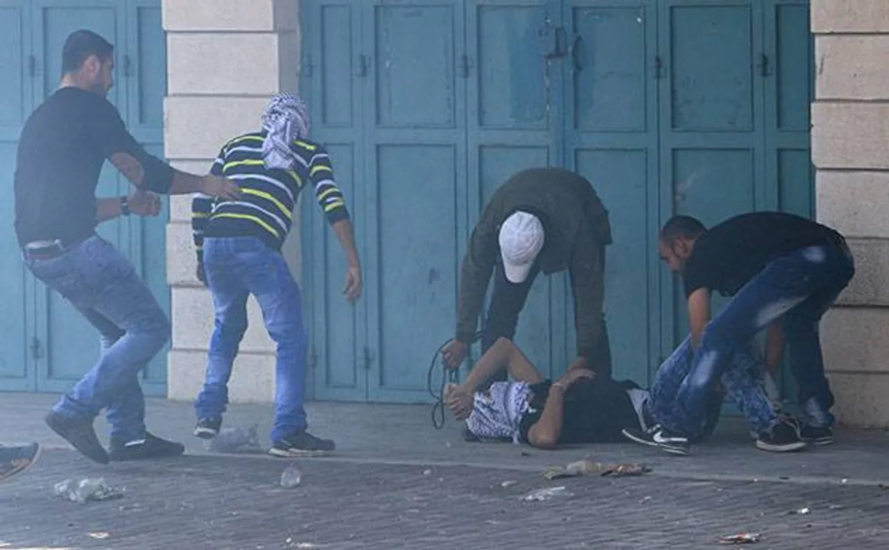 Rubber bullets can kill says study conducted over 27 years