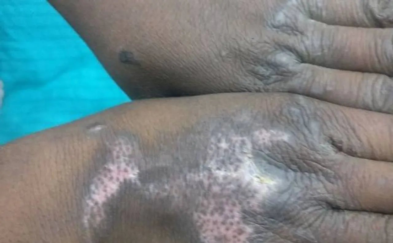 DWC arrests doctor for mentally, physically torturing tribal household helper from Jharkhand