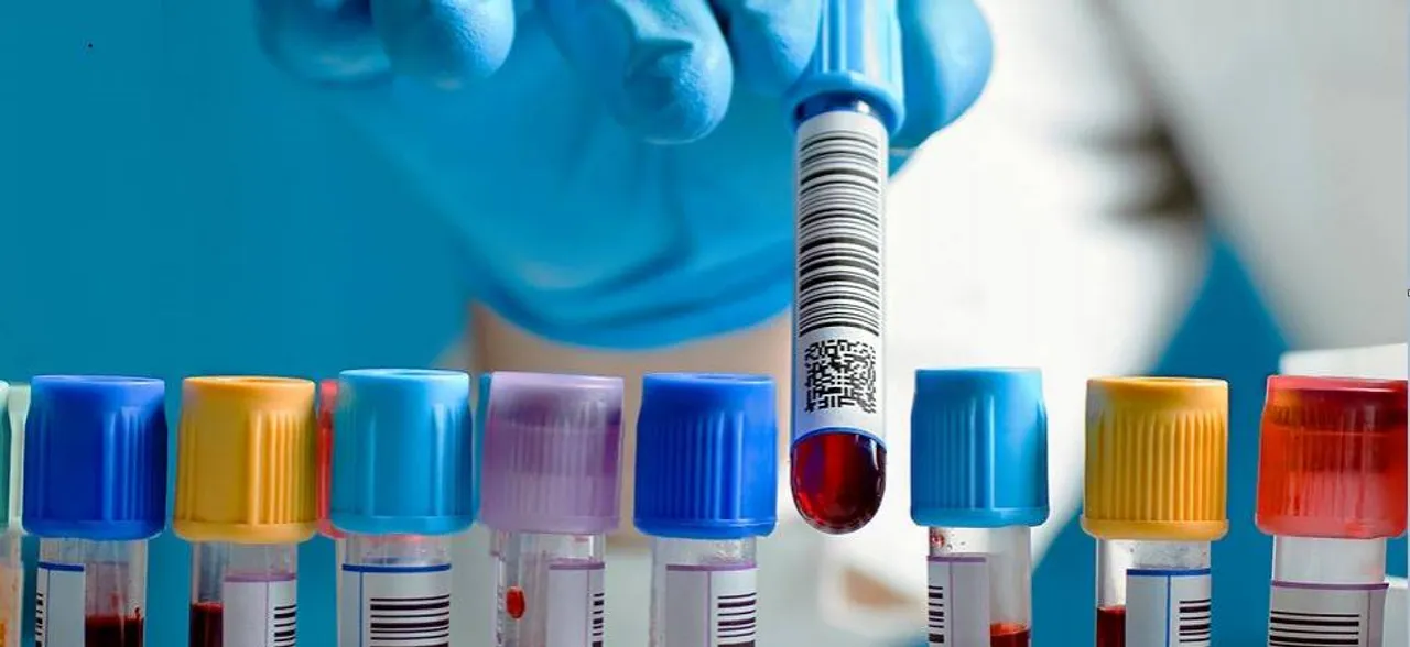 How new blood test can detect pancreatic cancer quickly, study reveals