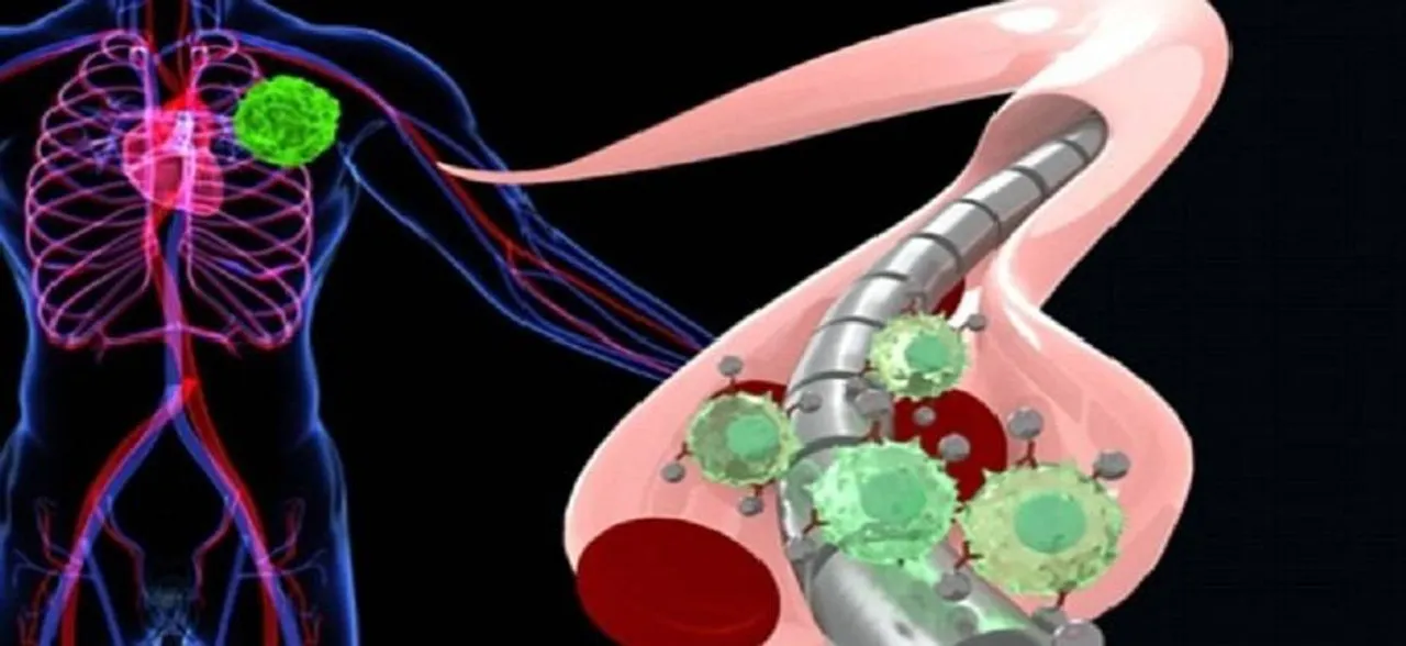How magnetic wire can help effectively detect cancer early