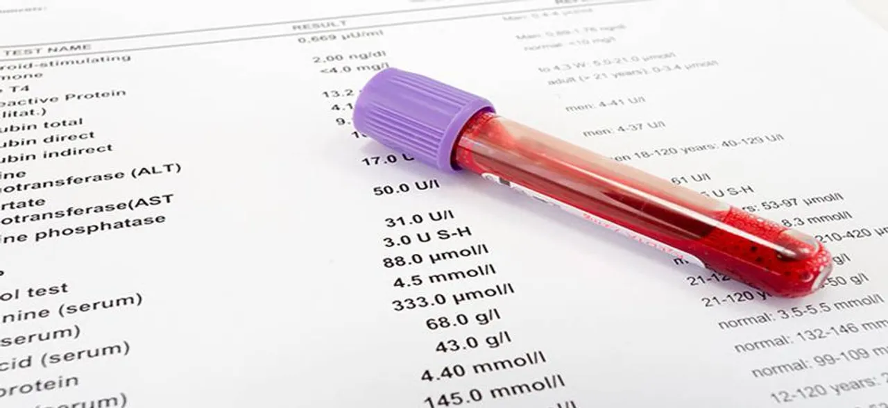 'World's first blood test to detect melanoma early developed'