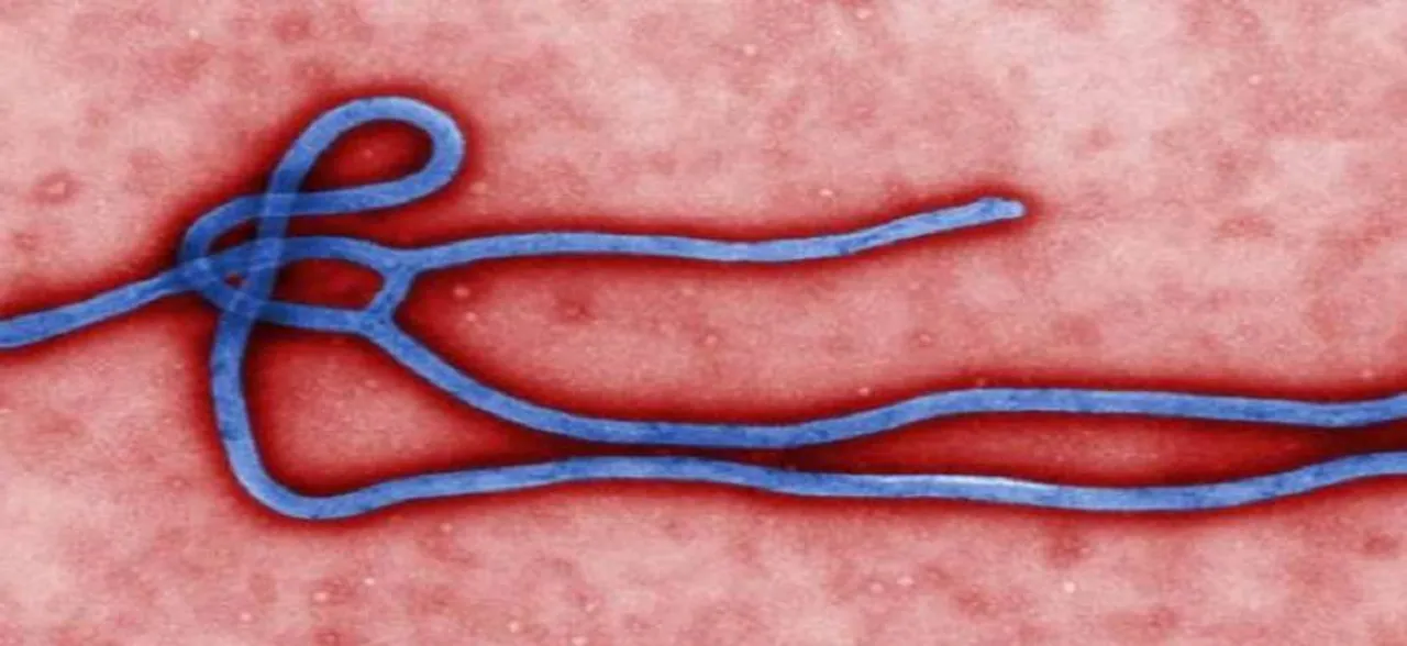 Ebola deaths in DR Congo rises to 49 with 2,000 feared â€˜contactsâ€™