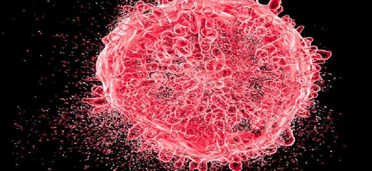 Breast cancer at primary stage can shutdown its own spread: Study 