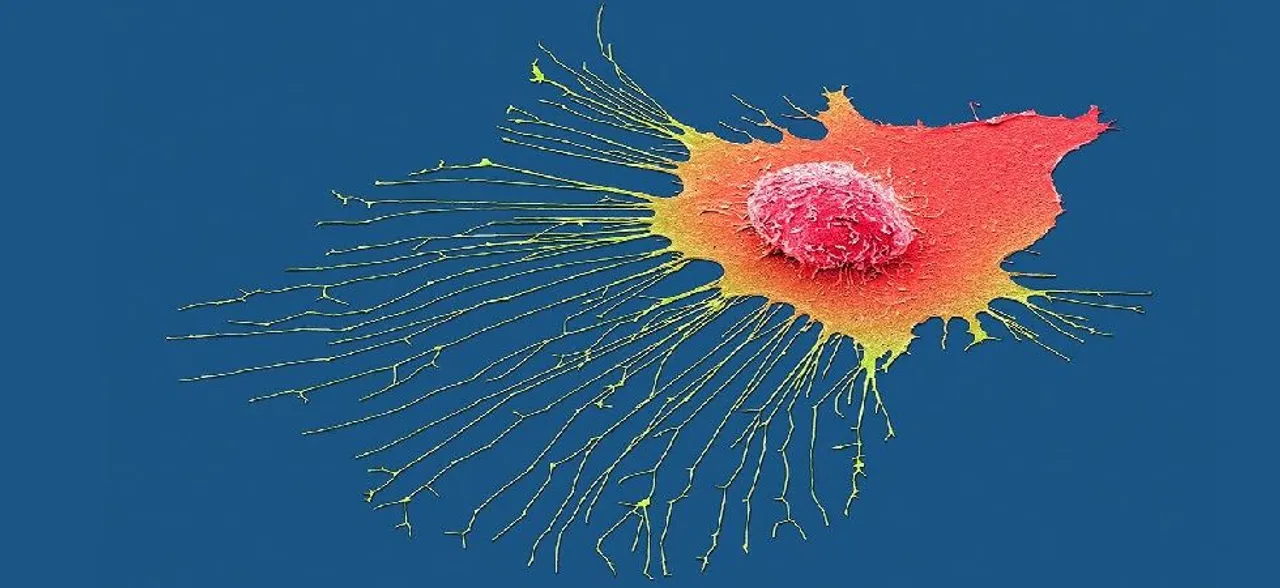 Cancer tracking AI can predict how tumours evolve  