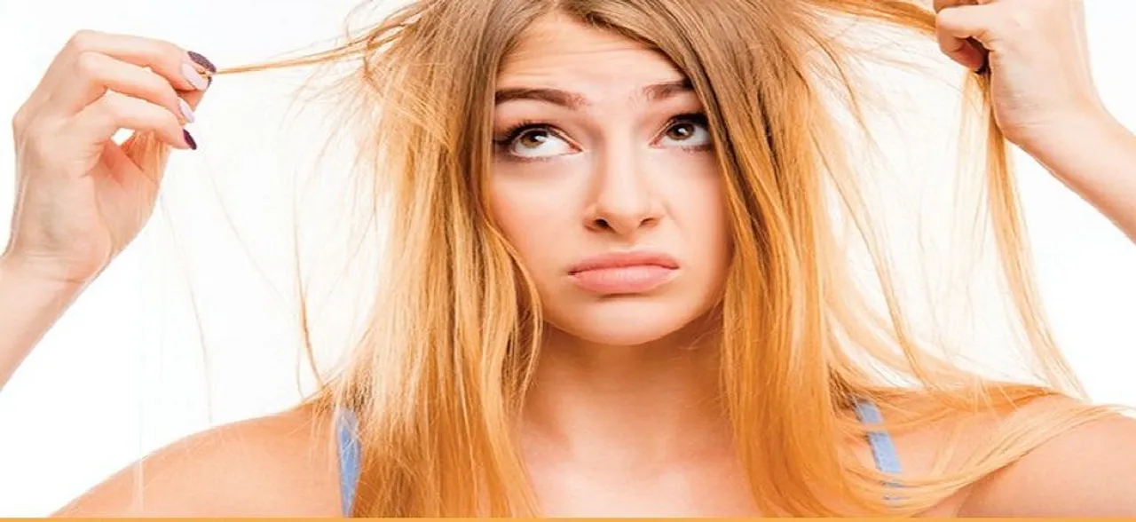 5 Sure shot natural remedies to prevent hair fall