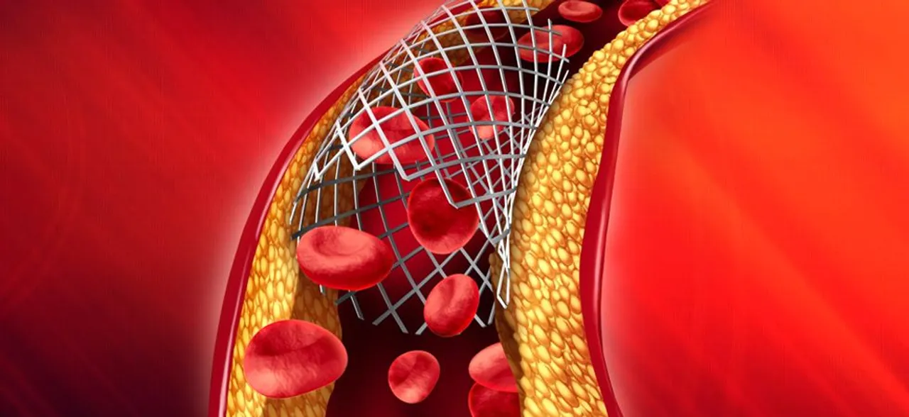 Made in India coronary stents as good as foreign ones: Study