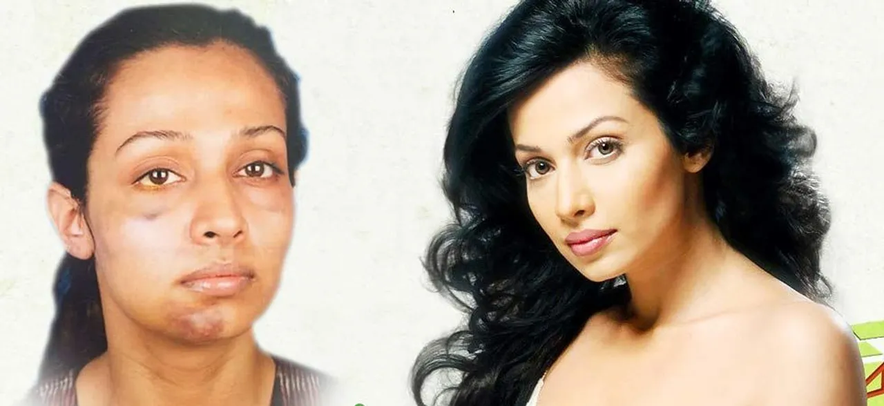 Stree actress accuses Gaurang Doshi of assault; Shares picture of broken jaw