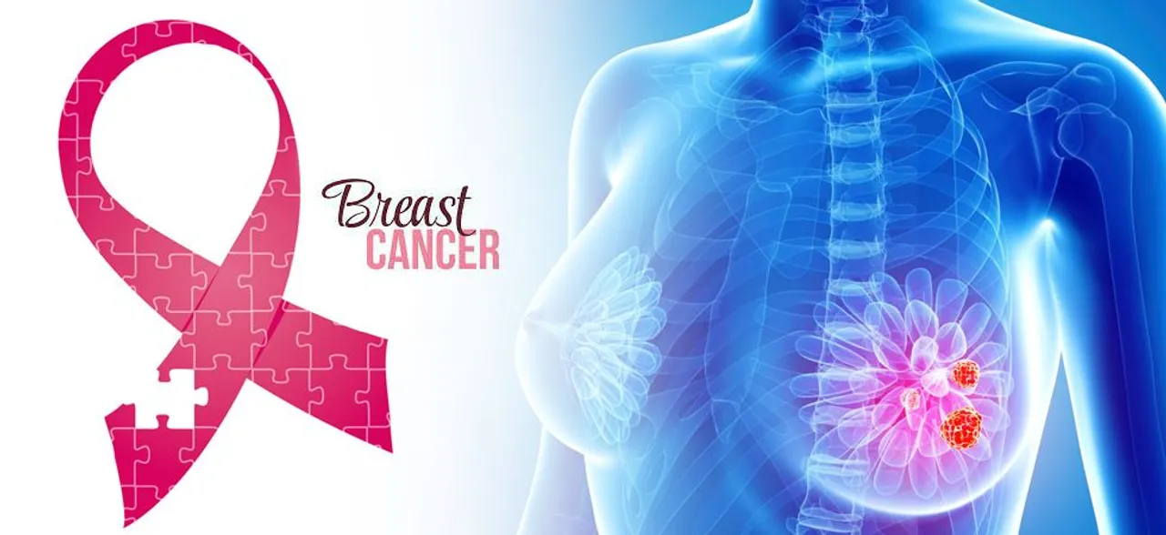 Breast Cancer: 'Access to detection remains a key challenge' 