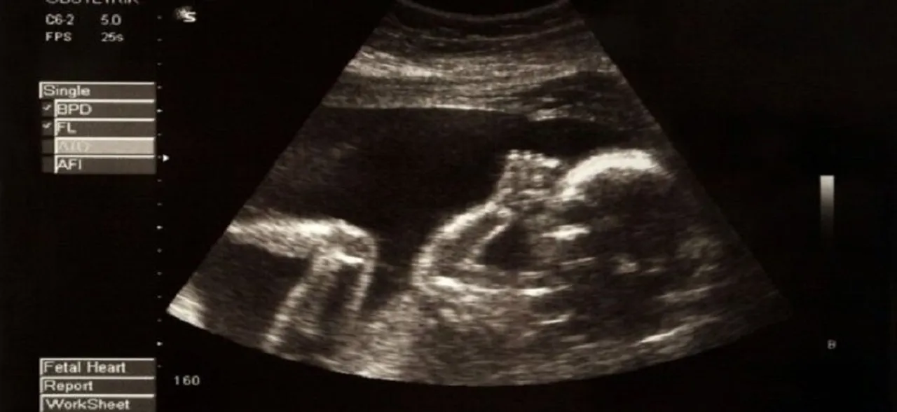 Abortion the silent killer of 2018, total death amounts to over 41 million