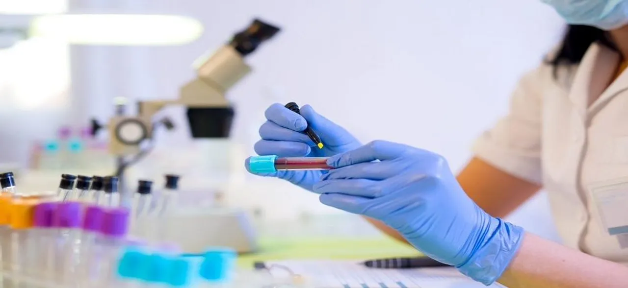 Blood test can now detect Alzheimerâ€™s decades before symptoms start showing, says study