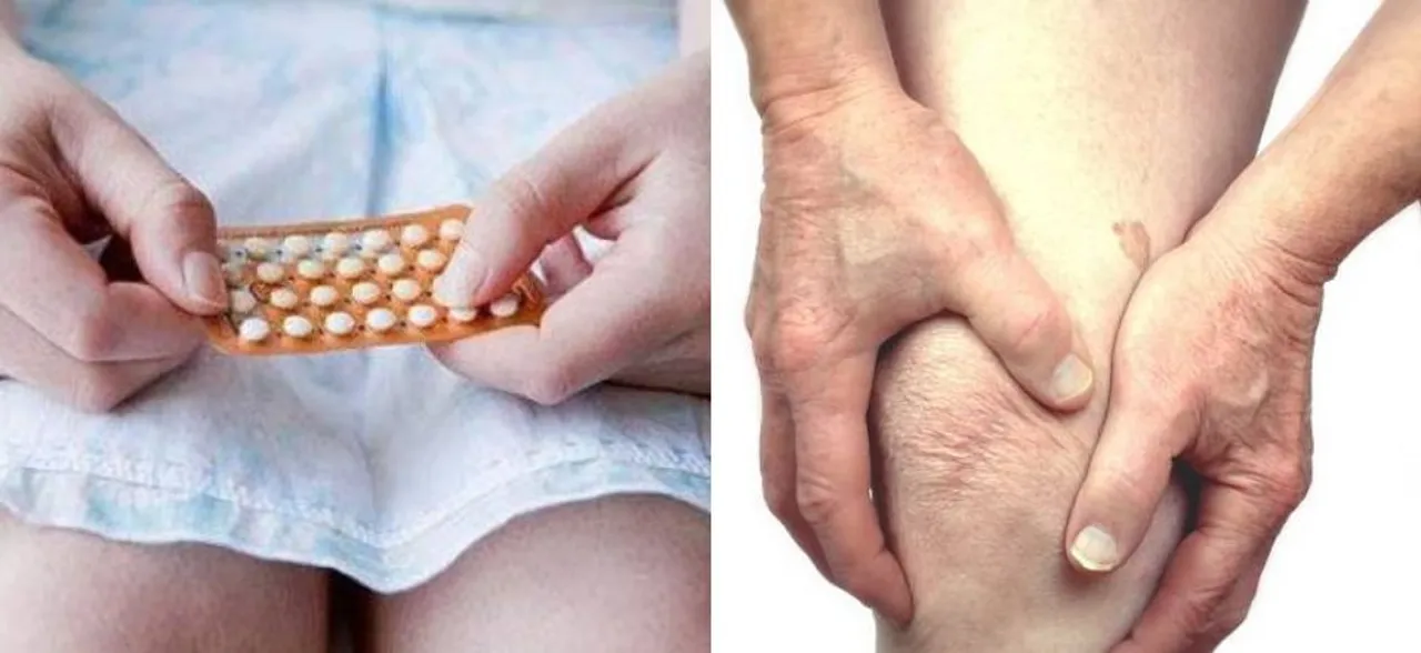 Oral contraceptives may protect women against knee injuries: Study