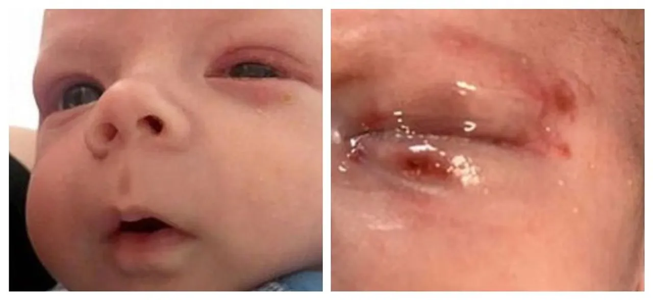 Donâ€™t let strangers kiss your baby! Infant contracts deadly Herpes virus after being kissed at christening