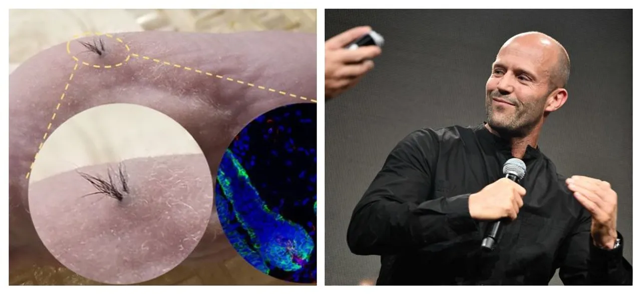 Say goodbye to baldness! Scientists claim to have found solution to growing new hair from stem cells