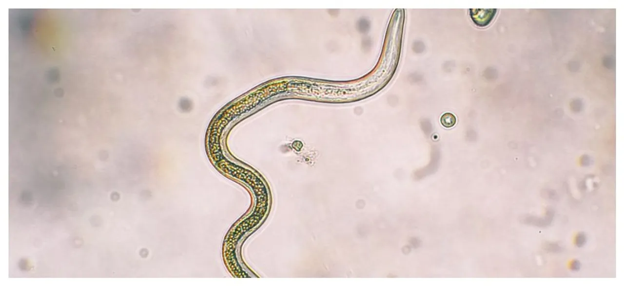 Scientists discover new method to kill drug-resistant parasites
