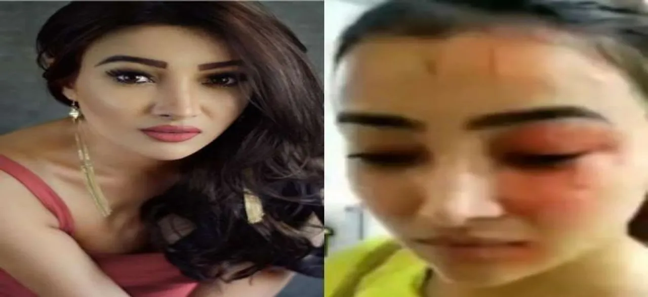  Diya Aur Baati Hum Actress Nalini Negi Lodges FIR Against Roomate Over Charges Of Physical Assault