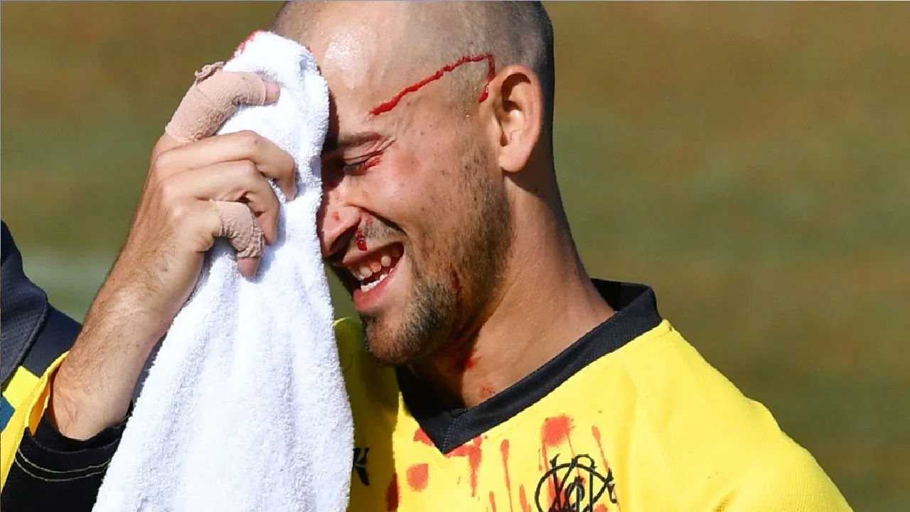 Australian Cricketer Ashton Agar Suffers Gruesome Injury After Dropping Brother In Marsh Cup Clash