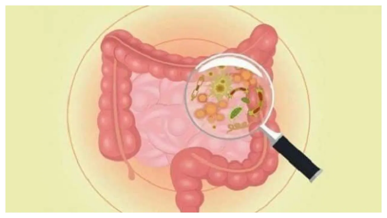 Gut Bacteria Linked To Risk Of Obesity, PCOS in teens: Study