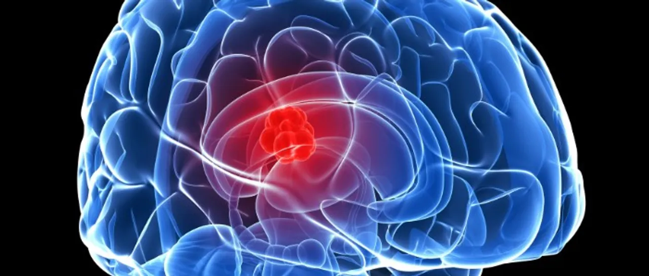 tumor