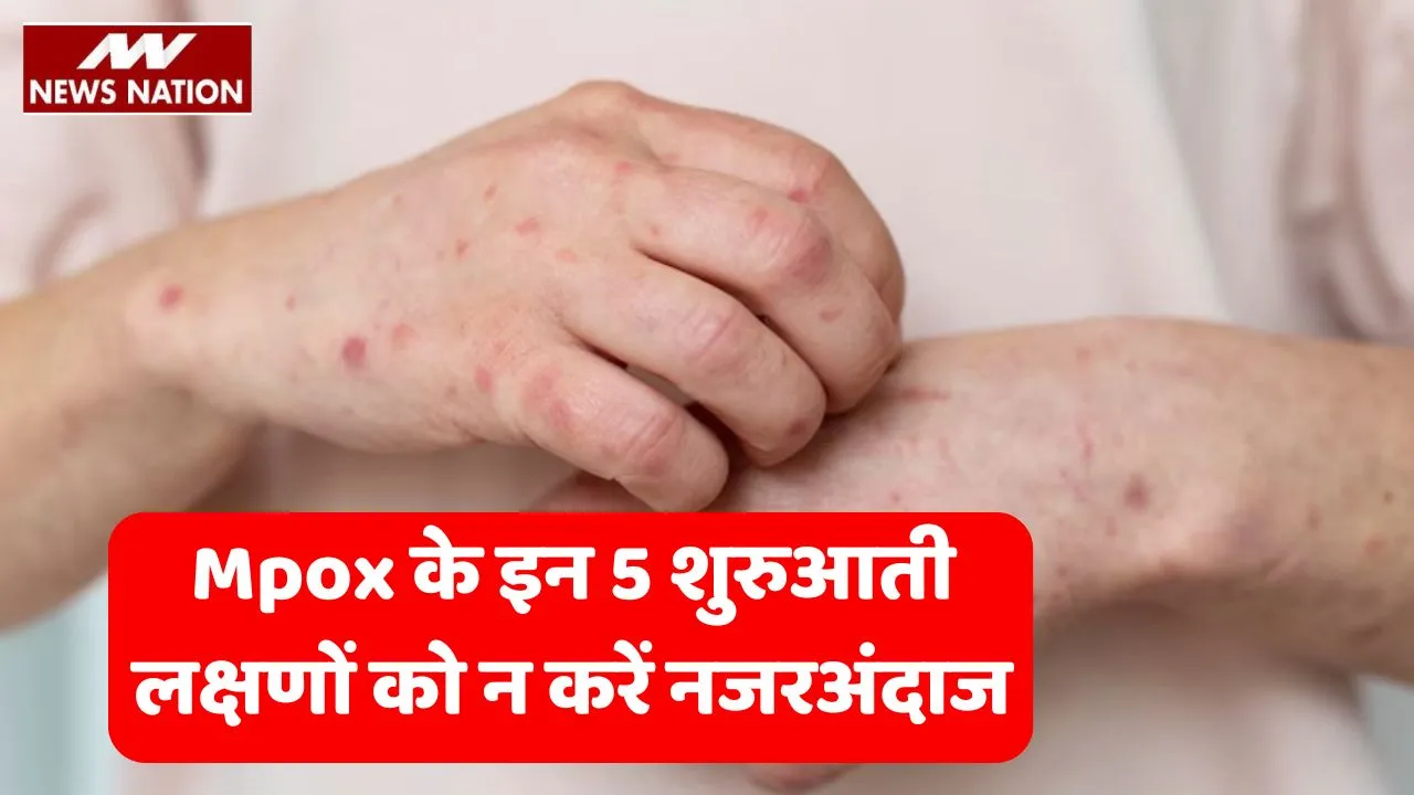 Mpox Early Symptoms