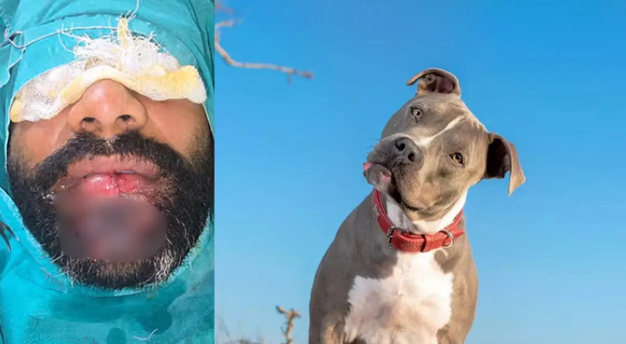 Pitbull attacks owner