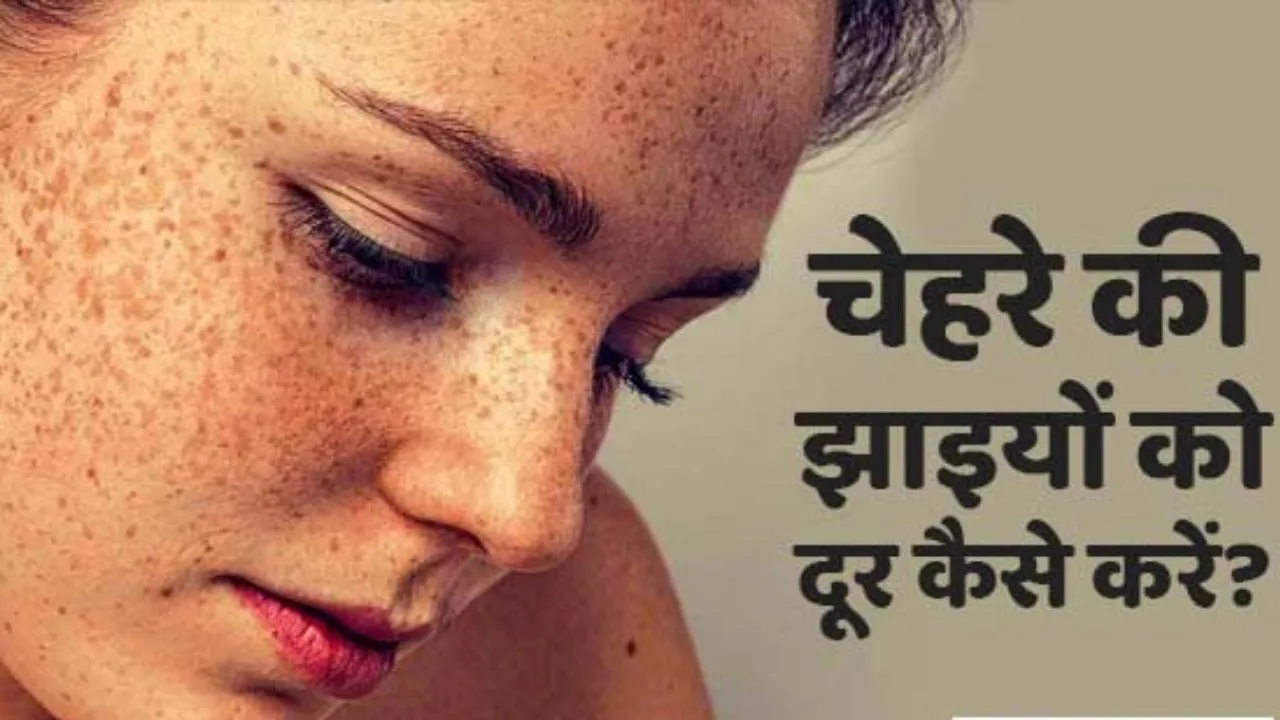 Pigmentation Remedies