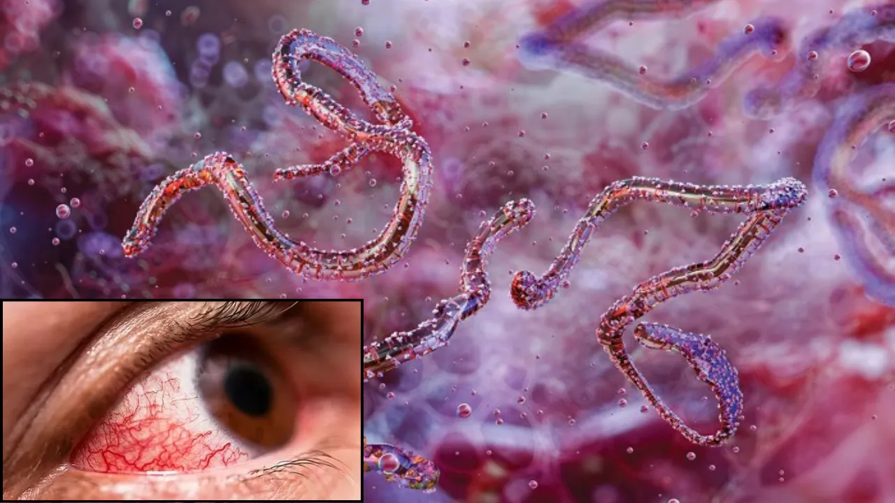 Marburg virus 