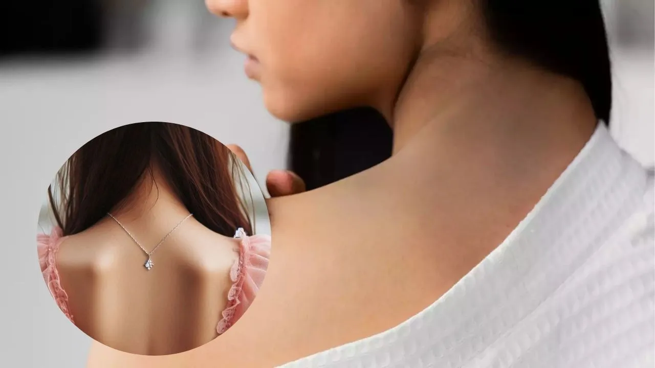 Dark Neck Home Remedies