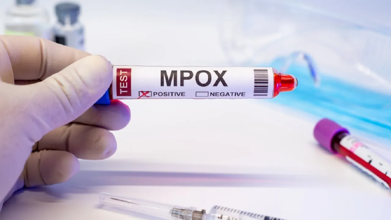MPOX Alert