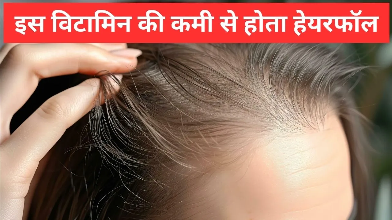 hair fall