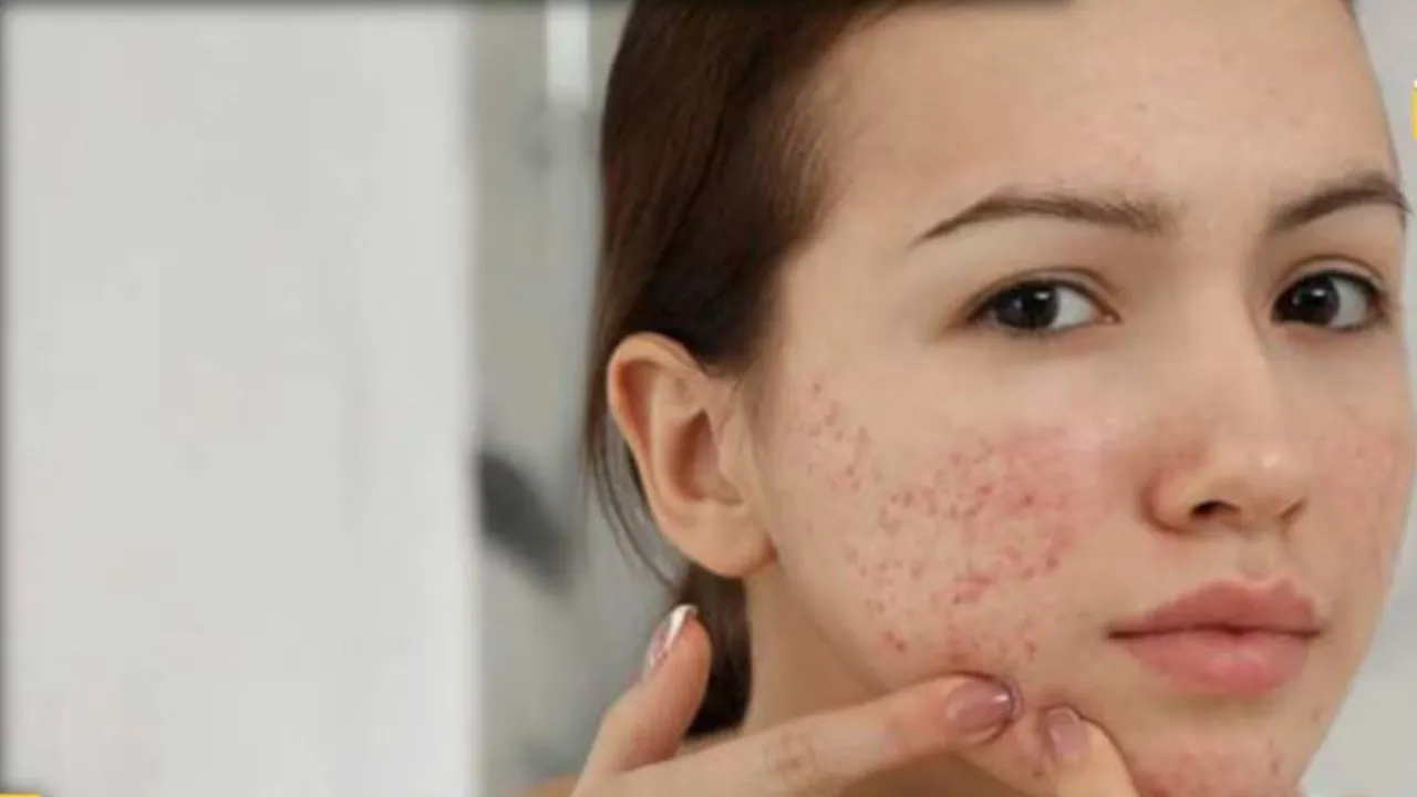 deficiency of vitamin 3