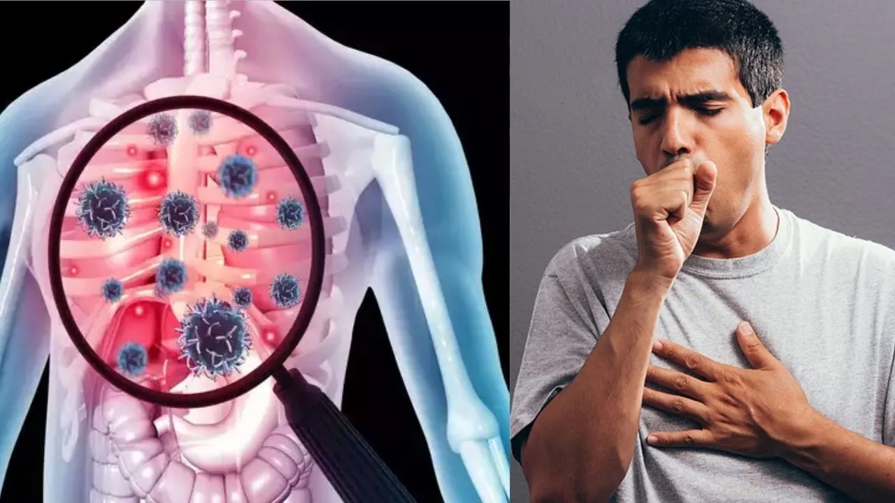 Chest Congestion Remedy