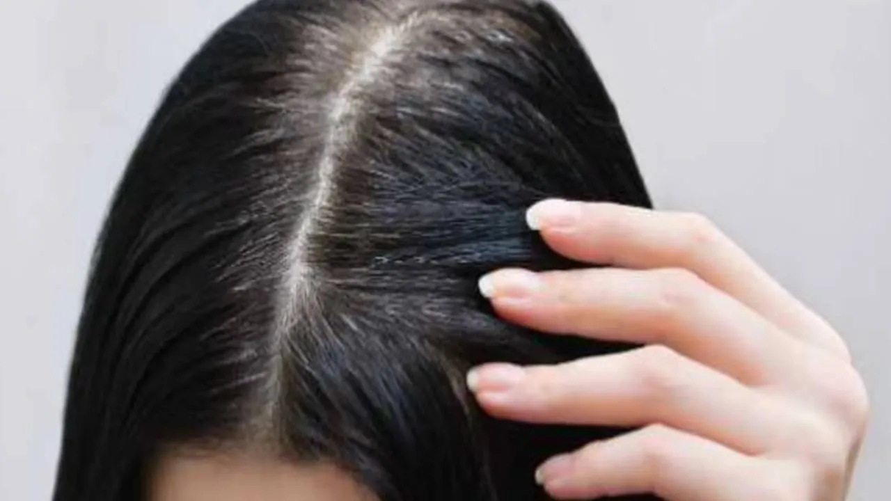 Home remedies for black hair